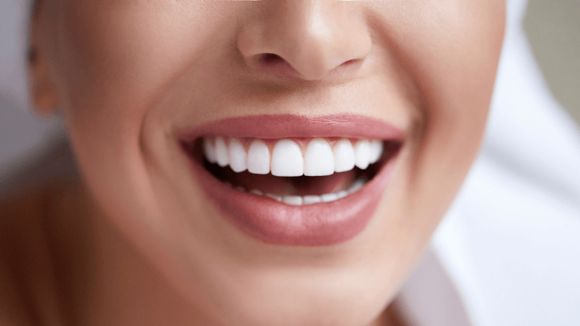 Woman with Invisalign smiling at Woodcroft Dental After deciding between Invisalign and traditional braces