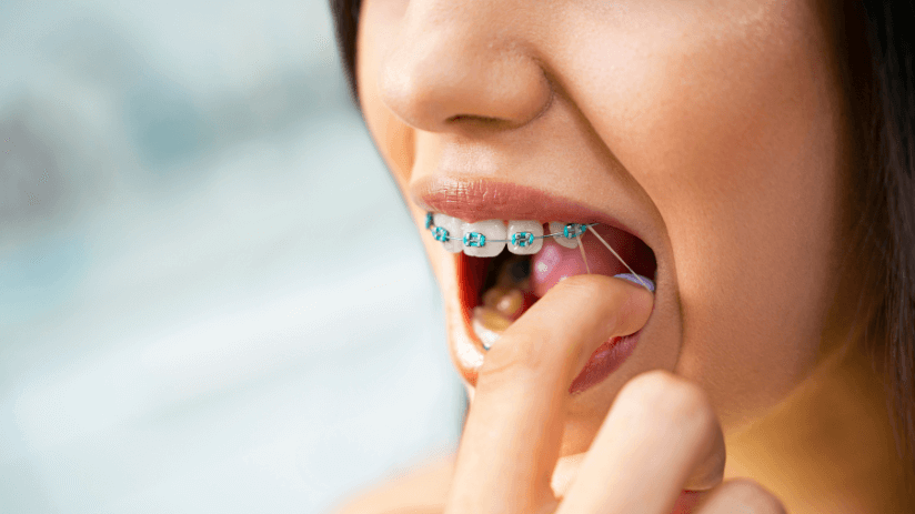 girl experiencing discomfort with her braces as she adjusts band